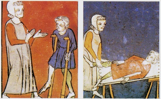 Chirurgijn verzorgt een kreupele. Miniatuur, ca. 1300. Rogier van Salerno, 'Practica Chirurgiae'. Londen, British Library.